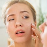 این میکروب ها به سلامت پوست شما کمک می کنند!