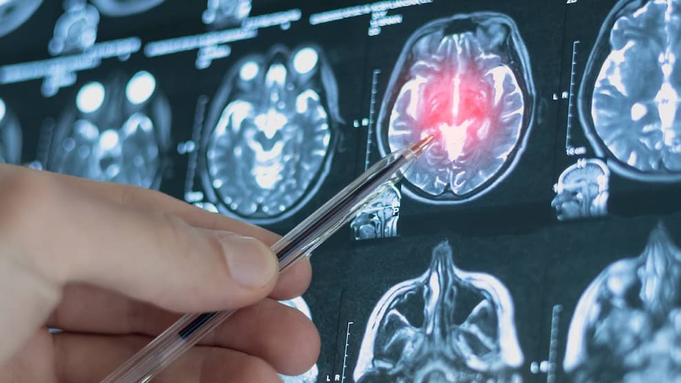 پنج مرحله رشد مغز و نقاط عطف حیاتی در ۹ تا ۸۳ سالگی