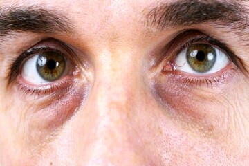 سلامت بینایی در سالمندی